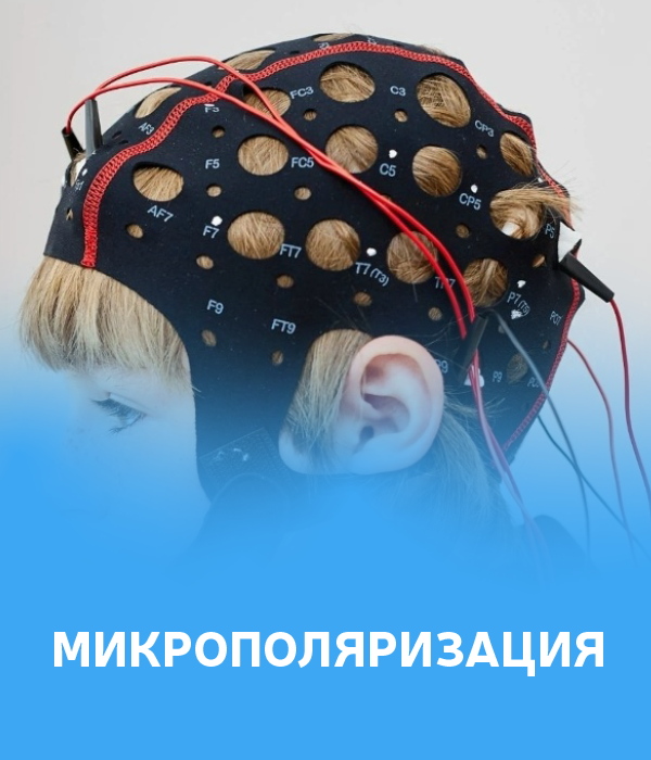 Микрополяризация