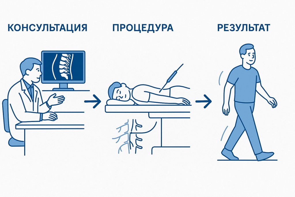 Этапы Радиочастотной Абляции.jpg Этапы Радиочастотной Абляции.jpg