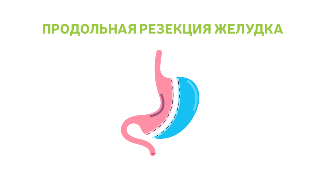 РЕЗЕКЦИЯ.png РЕЗЕКЦИЯ.png